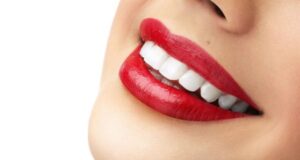 skolko stojat zubnye implanty v kitae otzyvy ob implantacii 6a1de8e