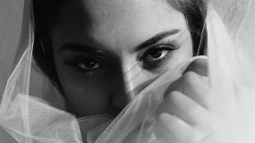 reabilitacija posle blefaroplastiki o chem objazatelno nuzhno znat 3615cb5