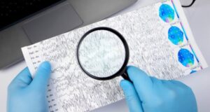 risk epilepsii rezko vozrastaet cherez god posle perenesennogo insulta 81516c4