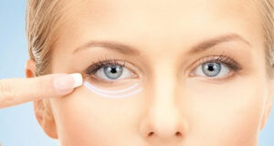 transkonjuktivalnaja blefaroplastika f5156a2