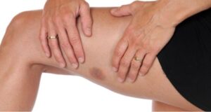 sinjaki mogut stat provesnikami raka 263d6db