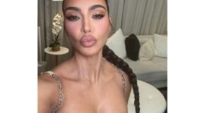 mur kardashjan i fon tiz zvezdy kotorye sdelali samye strannye plasticheskie operacii c739cd3